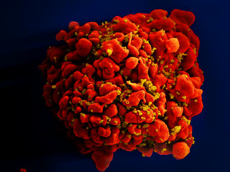 Produced by the National Institute of Allergy and Infectious Diseases (NIAID), this digitally colorized scanning electron microscopic (SEM) image depicts a single, red colored H9-T cell that had been infected by numerous, spheroid shaped, mustard colored human immunodeficiency virus (HIV) particles, which can be seen attached to the cell's surface membrane.